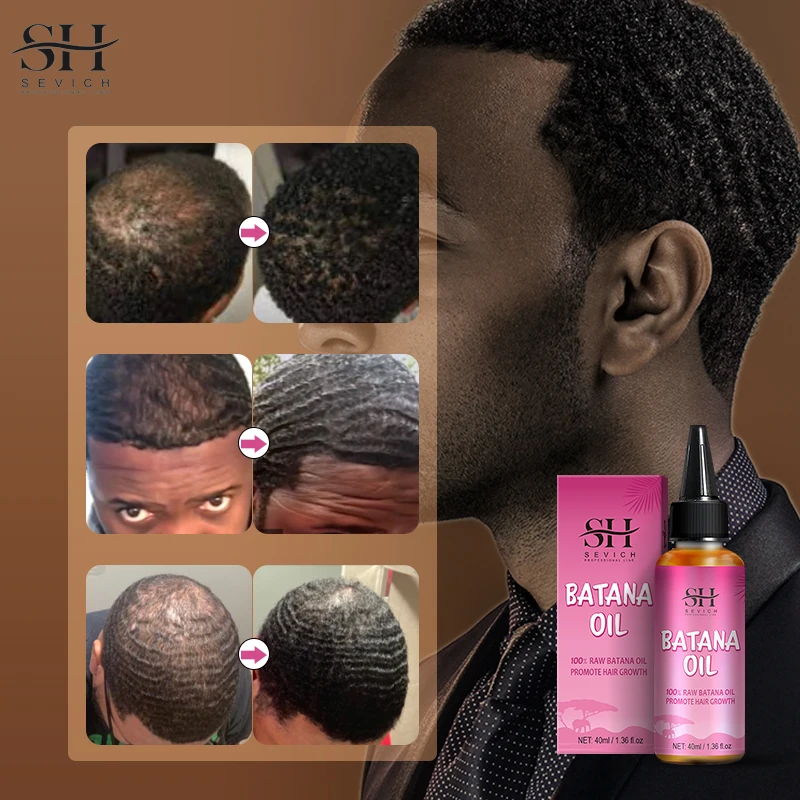 Natural 100% Pure Batana Oil For Hair Growth Batana Oil Butter Hair Mask From Honduras Hair Loss Treatment For Black Men & Women - Image 4